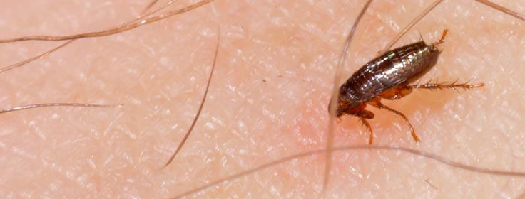 flea up-close on human skin
